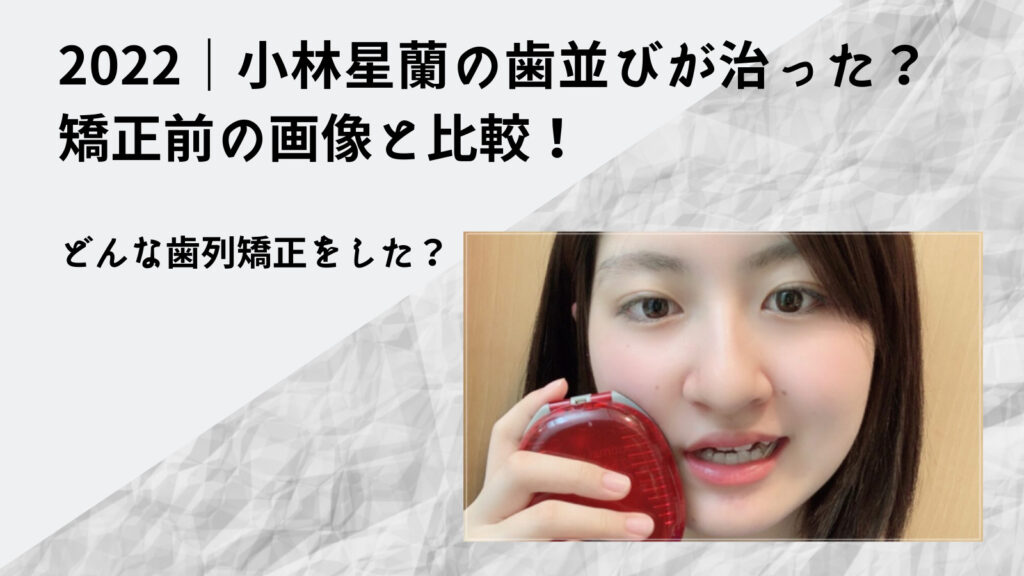 小林星蘭の歯並び